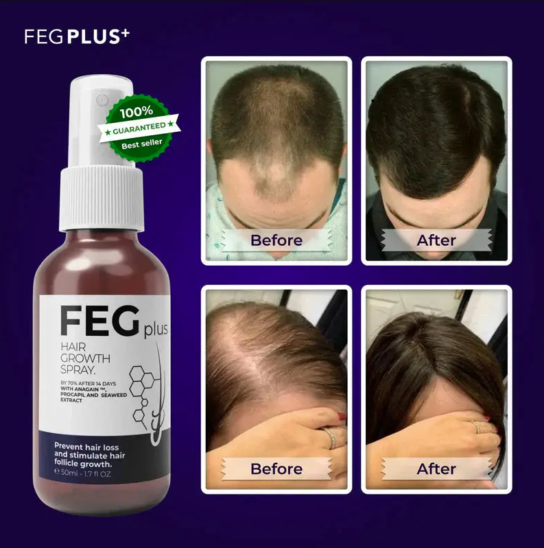 FEG Hair Growth Spray – Natural Formula for Hair Regrowth & Thickness